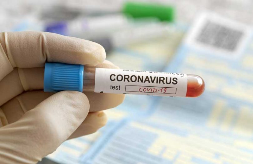 Test na koronawirusa COVID-19